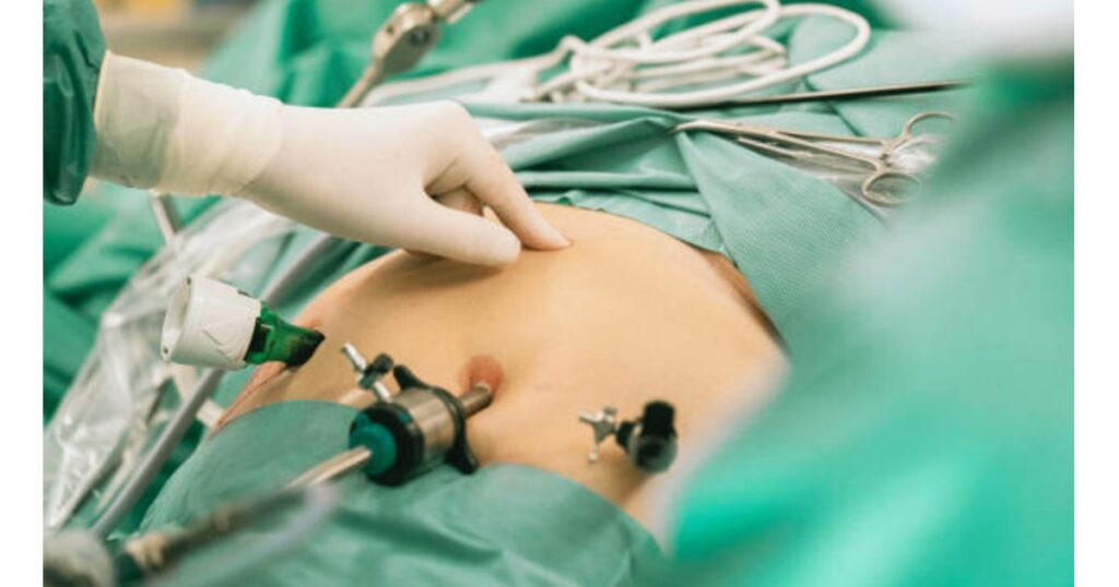 Cheapest Weight Loss Surgery UK