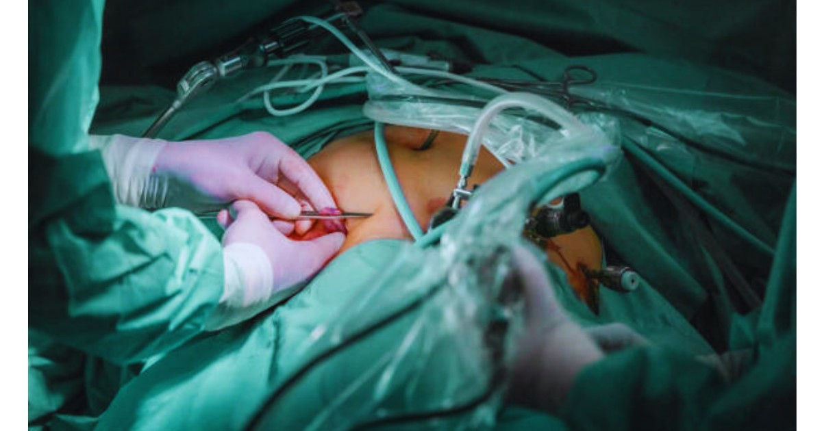Cheapest Weight Loss Surgery UK