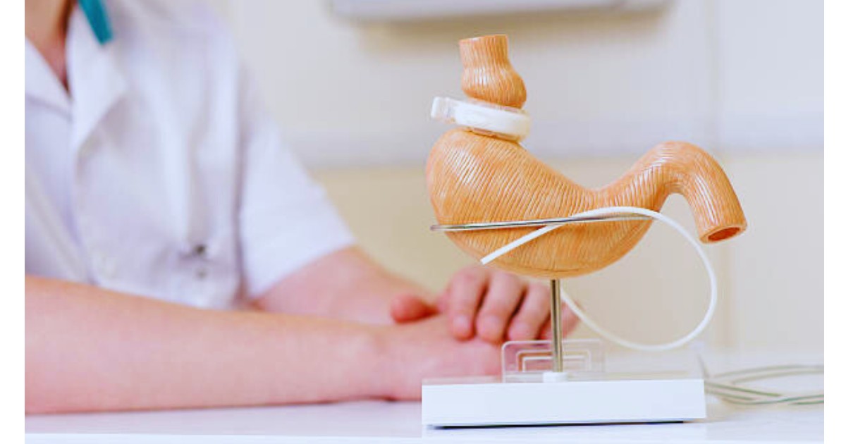 Gastric Band Surgery