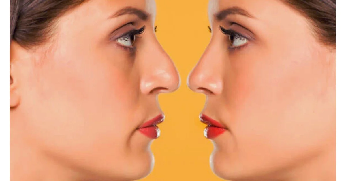 How to Remove Face Fat